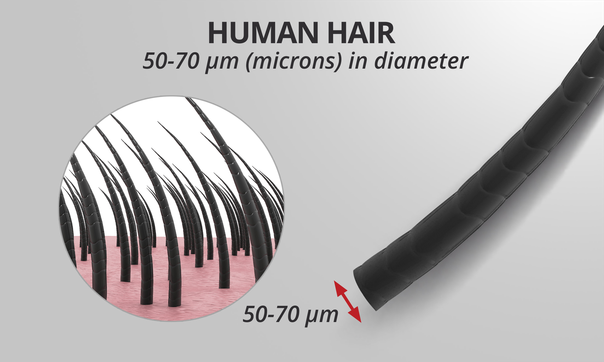 A human hair is cheap about 50 μm in diameter